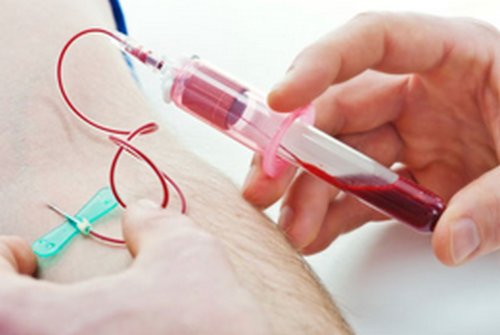 the blood draw is being done with a butterfly needle.photo