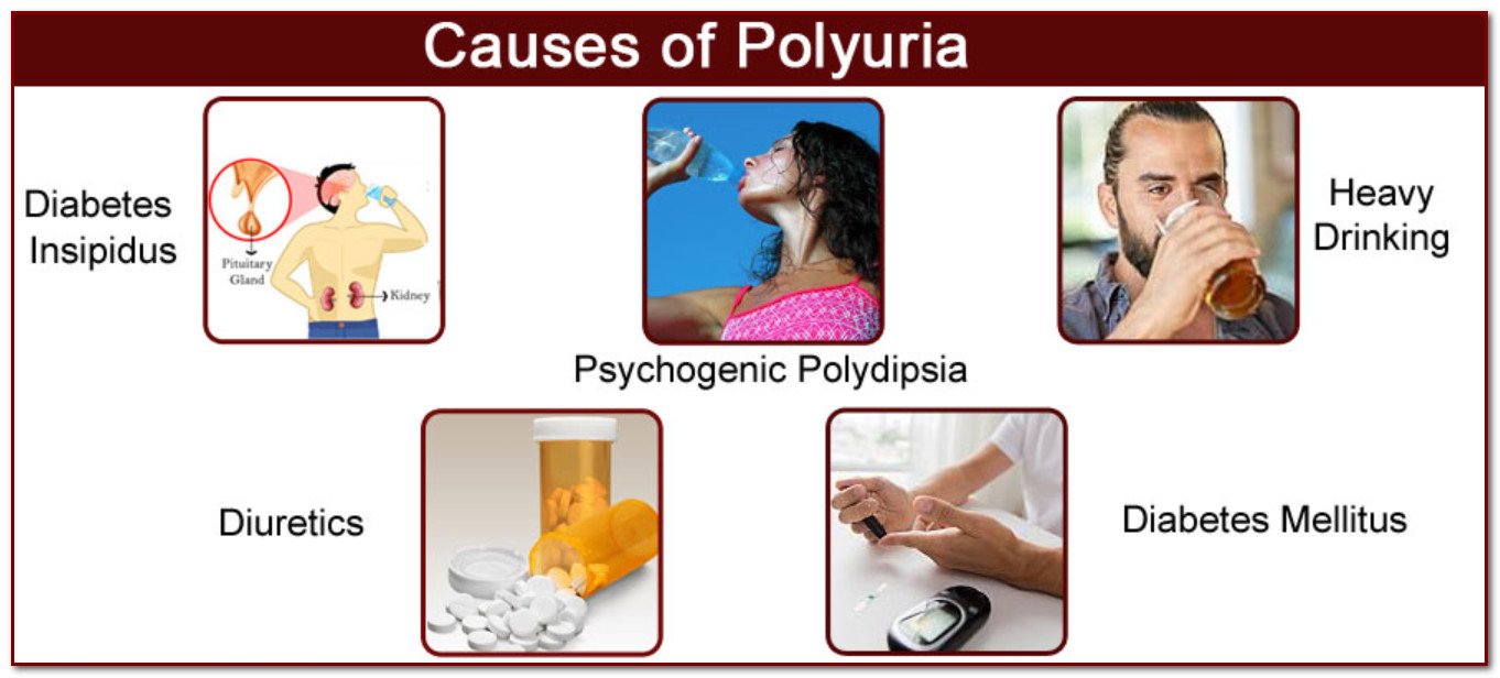causes of polyuria differential diagnosis